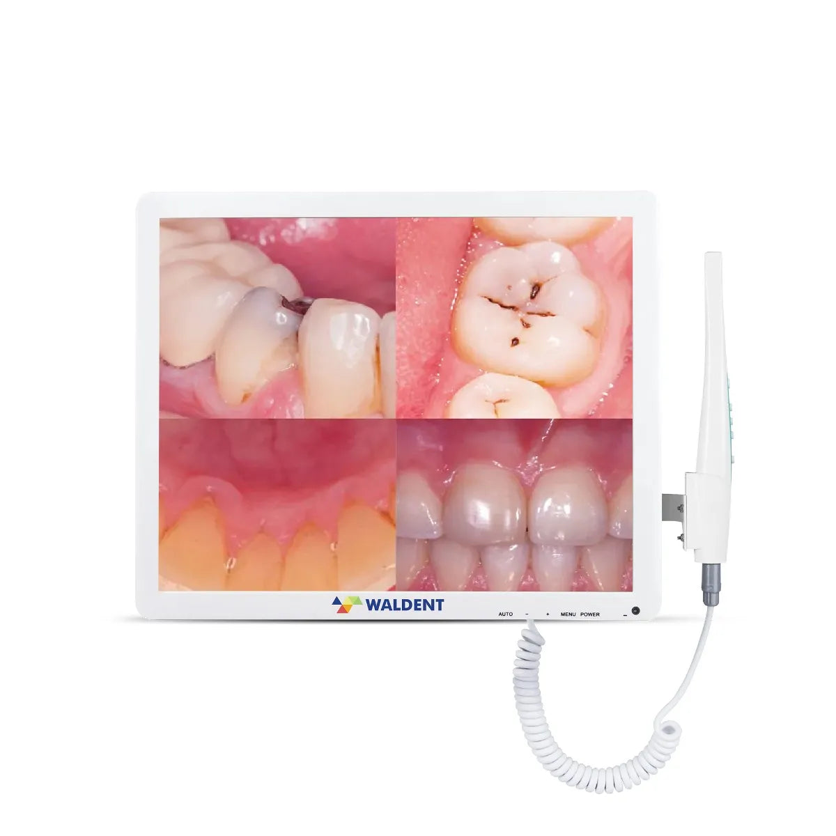 Waldent Smart Cam with PMS Intra Oral Camera