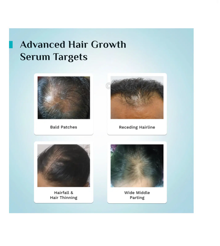 Pilgrim 3% Redensyl, 4% Anagain & 5% Capilia Stem Cell Complex Advanced Hair Growth Serum