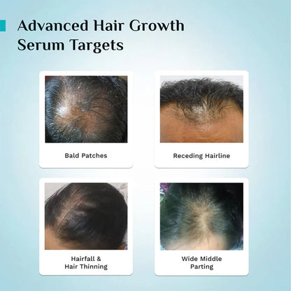 Pilgrim 3% Redensyl, 4% Anagain & 5% Capilia Stem Cell Complex Advanced Hair Growth Serum
