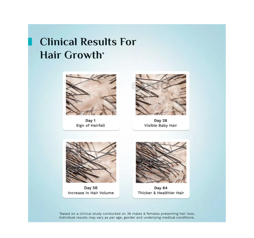 Pilgrim 3% Redensyl, 4% Anagain & 5% Capilia Stem Cell Complex Advanced Hair Growth Serum