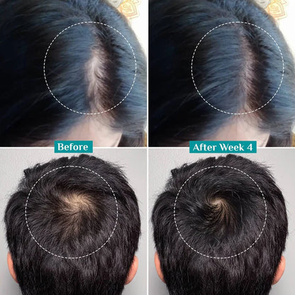 Pilgrim 3% Redensyl, 4% Anagain & 5% Capilia Stem Cell Complex Advanced Hair Growth Serum
