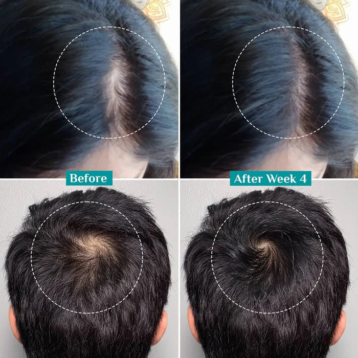 Pilgrim 3% Redensyl, 4% Anagain & 5% Capilia Stem Cell Complex Advanced Hair Growth Serum