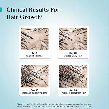 Pilgrim 3% Redensyl, 4% Anagain & 5% Capilia Stem Cell Complex Advanced Hair Growth Serum