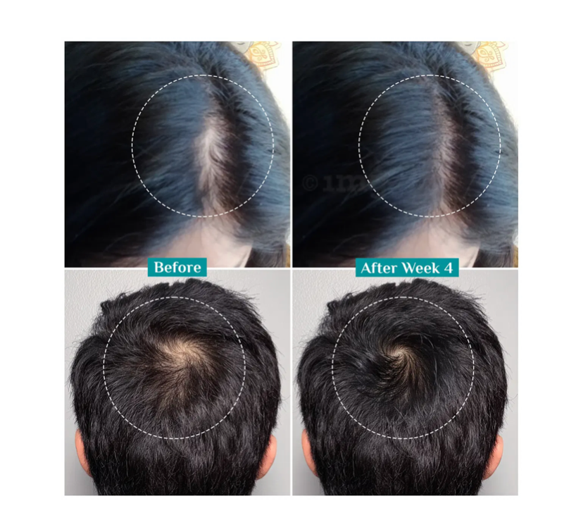 Pilgrim 3% Redensyl, 4% Anagain & 5% Capilia Stem Cell Complex Advanced Hair Growth Serum
