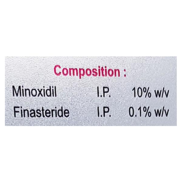 Minscalp F 10% Solution 60ml