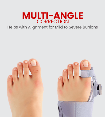 AGEasy Bunion Corrector â€“ Realign Your Toe (Free Toe Exerciser) - Global Surgicals