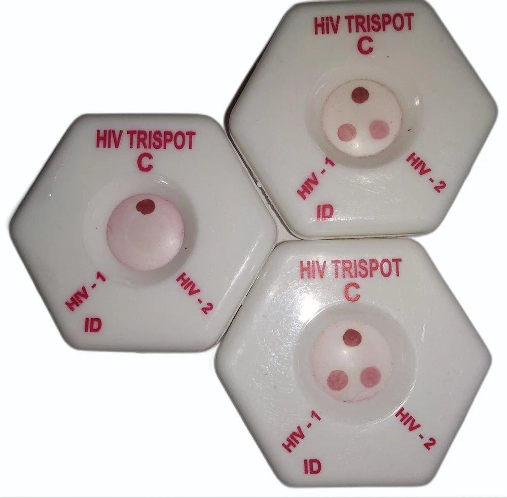 Aidscan HIV - 1/2 Trispot Rapid Card - Global Surgicals