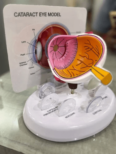 Asf Cataract Model Eye - Global Surgicals