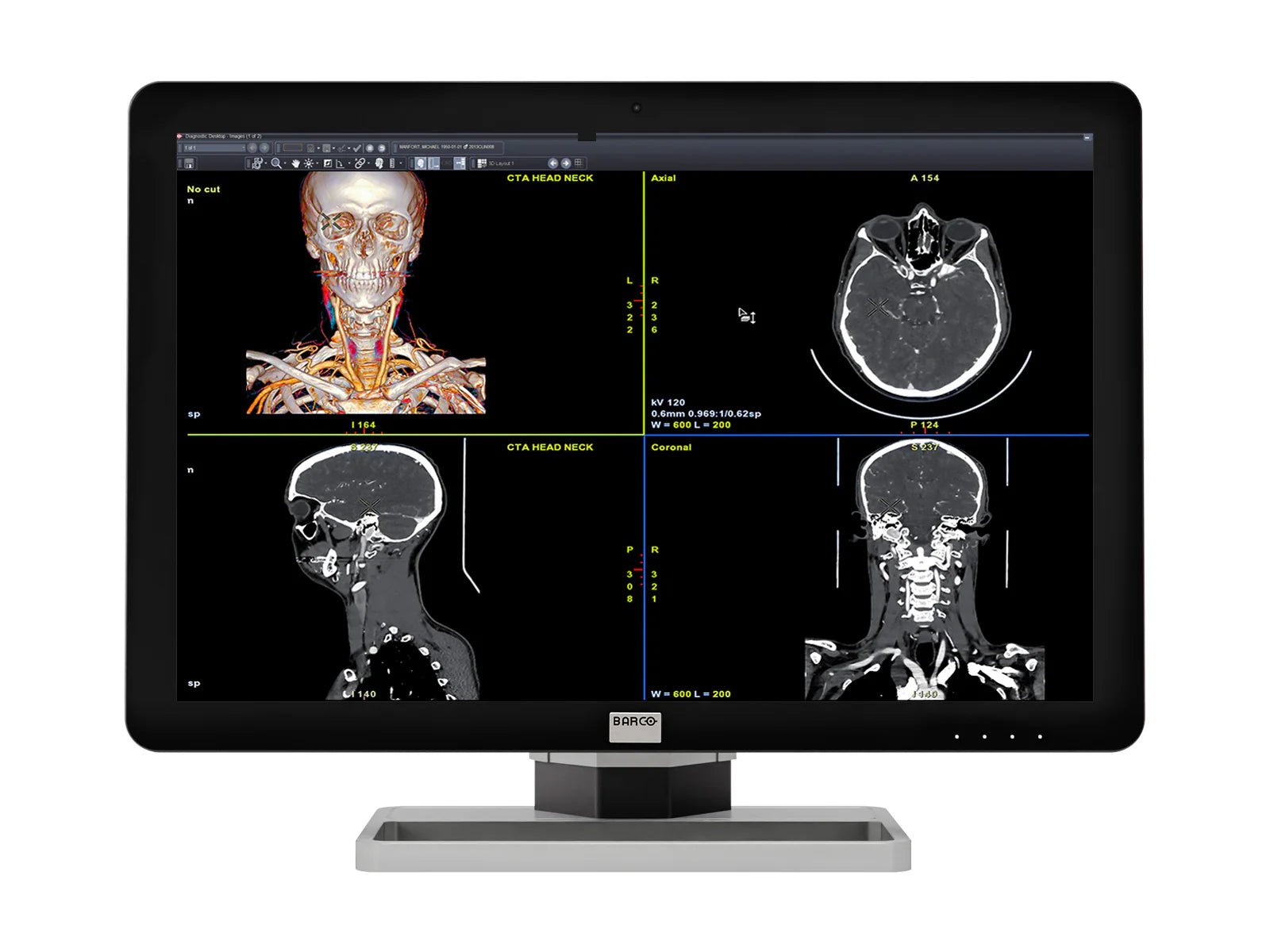 Barco Flat Panel Monitor - Global Surgicals