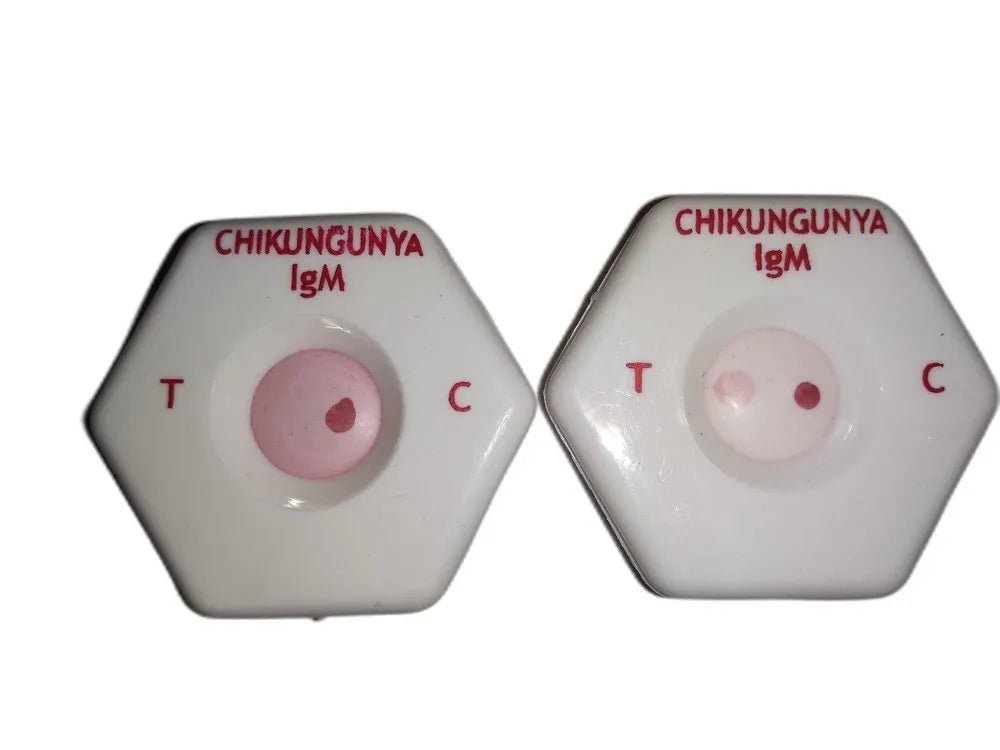 Bhat Bio - Scan Chikungunya IgM Spot Card - Global Surgicals