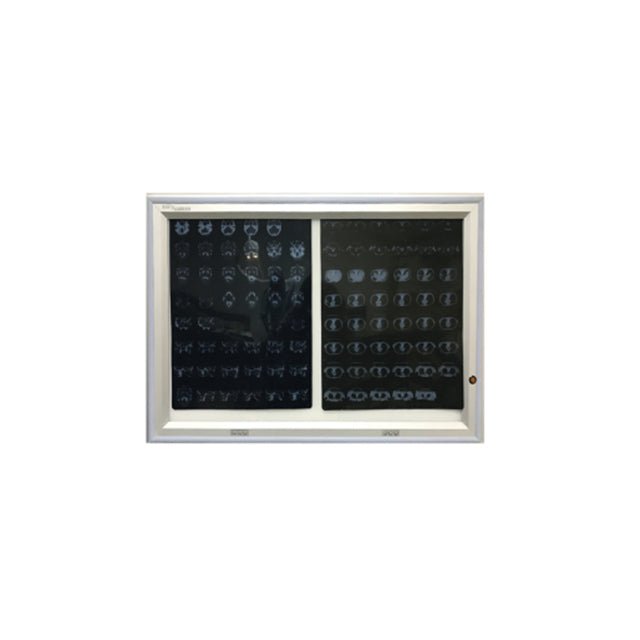 BIO - X Flush Mounted X Ray View Box - Global Surgicals