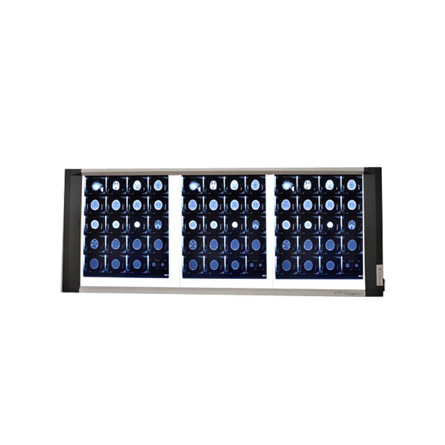 BIO - X LED X Ray View Box - Global Surgicals