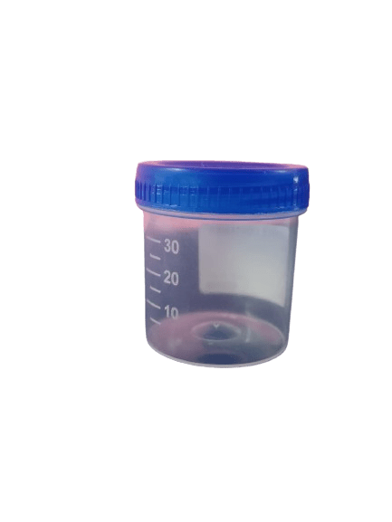 Buy Well Urine Container Non Sterile - Global Surgicals