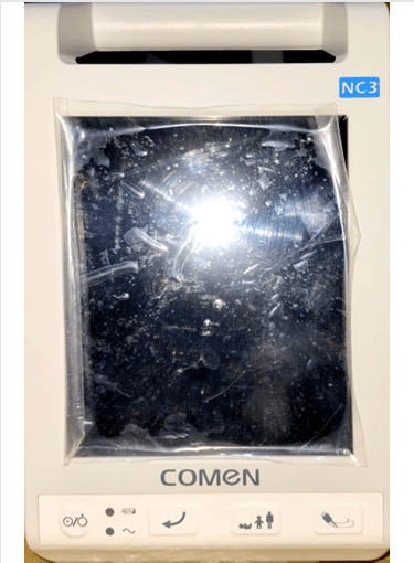Comen Vital Sign Patient Monitor Without Temperature - Global Surgicals