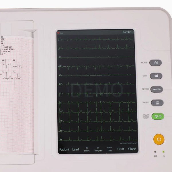 Contec New Electrocardiograph ECG Machine - Global Surgicals