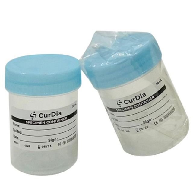 Curdia Urine Container Non Sterile - Global Surgicals