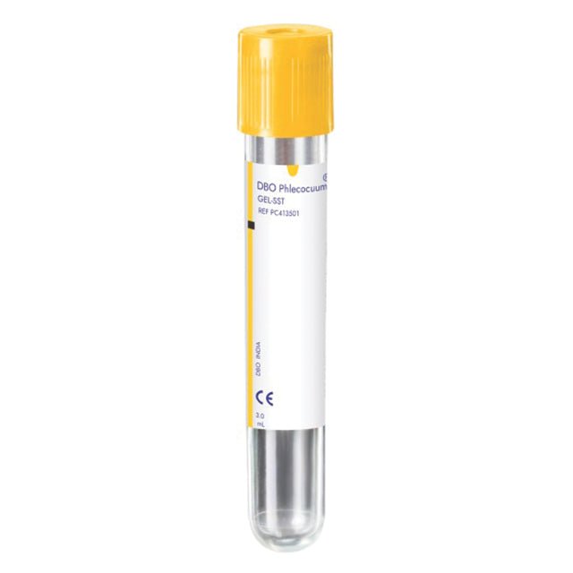 DBO Gel Non Vacuum Blood Collection Tube - Global Surgicals