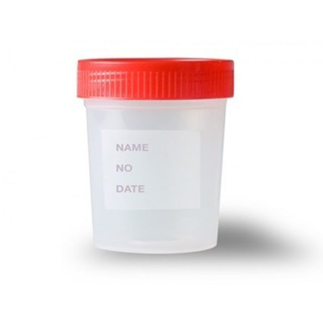 Fusion Biotech Urine Container Non Sterile - Global Surgicals