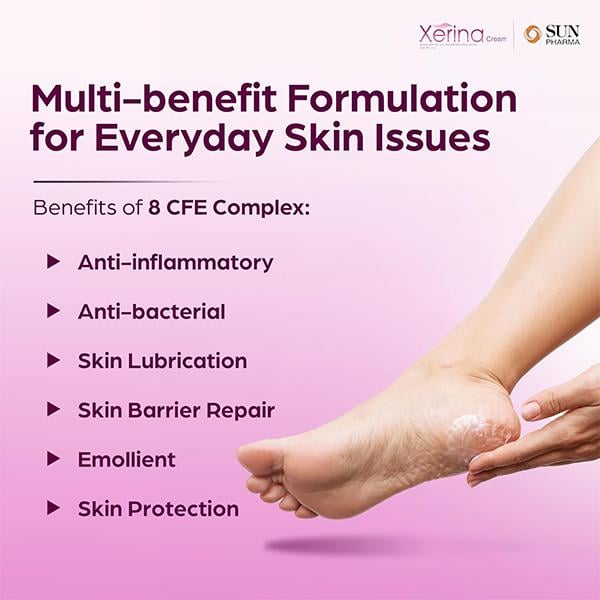 Xerina Cream 50gm