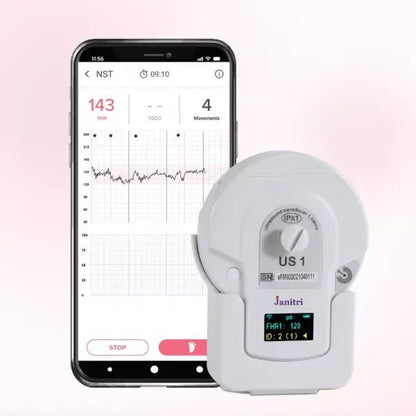 Keyar DT Lite - Home Nonstress Test (NST) - Global Surgicals