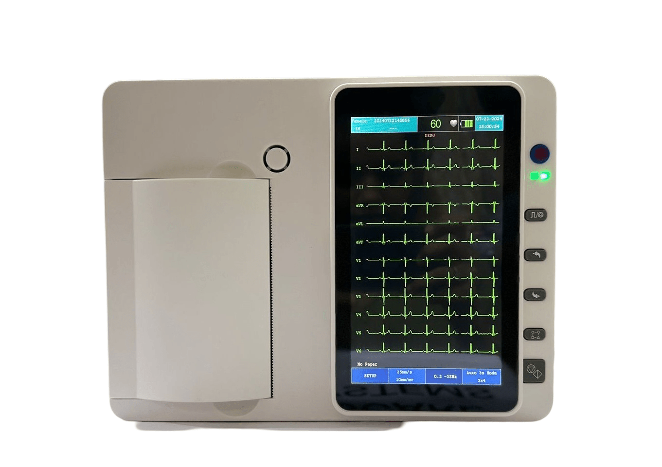 Korrida 3 Channel ECG Machine - Global Surgicals
