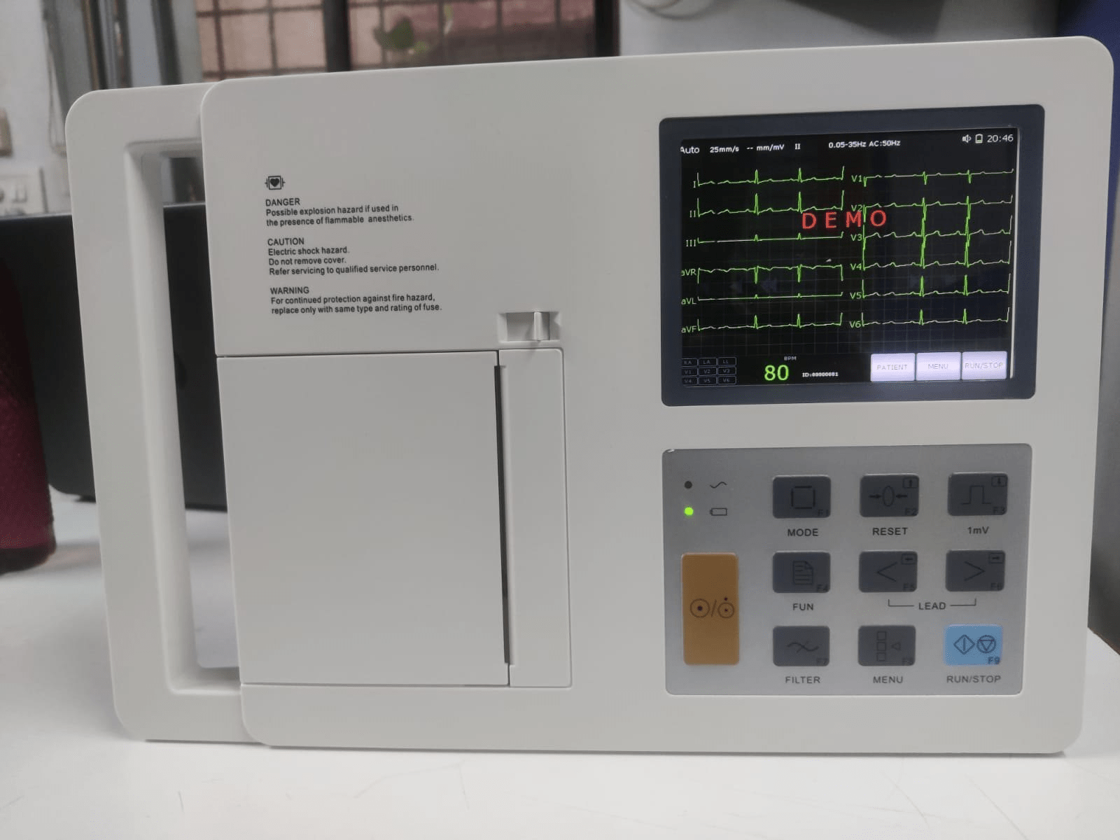 Korrida 3 Channel ECG Machine KM - 3E - Global Surgicals
