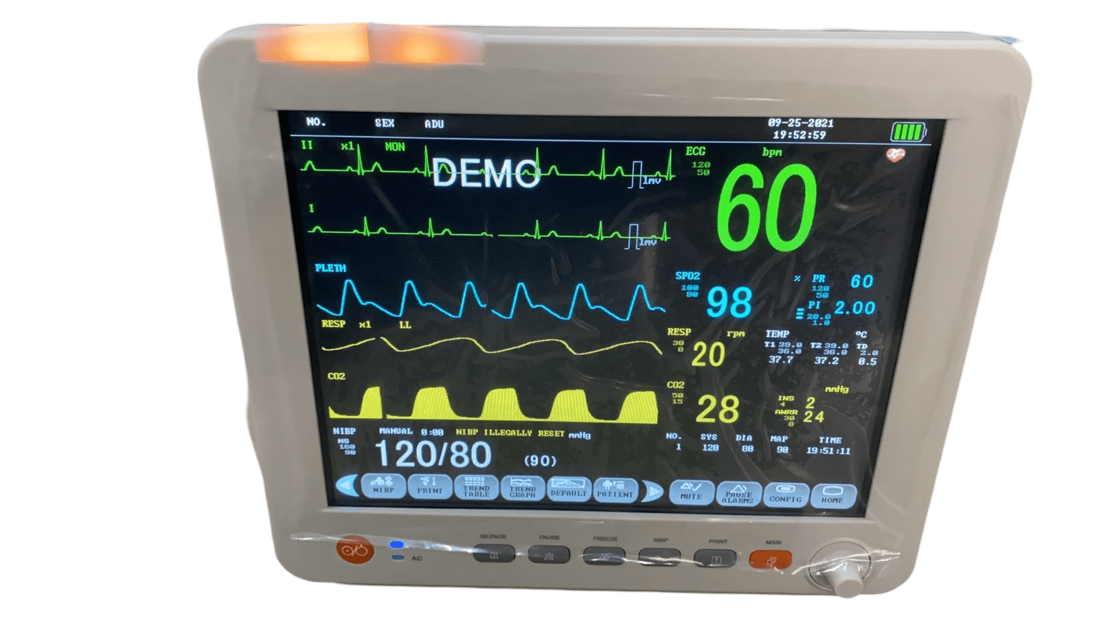 Korrida Modular Patient Monitor - Global Surgicals