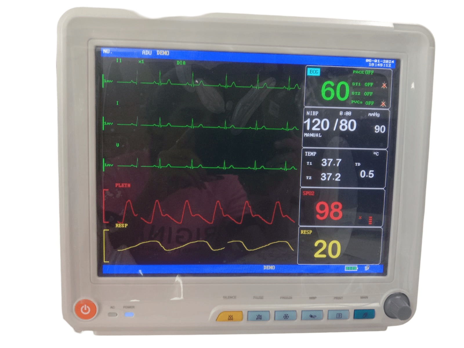 Korrida Multipara Monitor - Global Surgicals