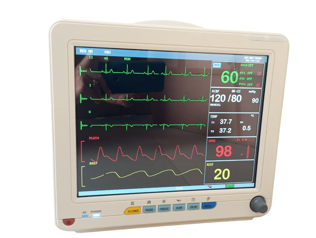 Korrida Multipara Monitor - (KM - 12D1) - Global Surgicals