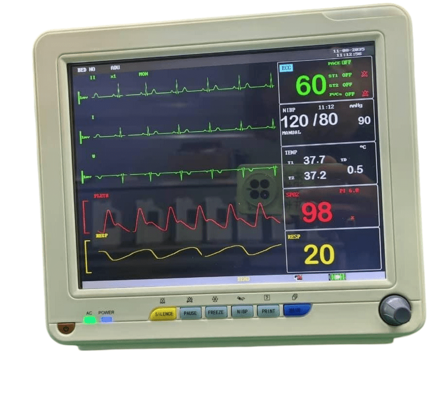 Korrida Veterinary Multipara Monitor - Global Surgicals