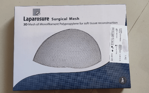 Laparosure 3D Surgical Mesh - Global Surgicals