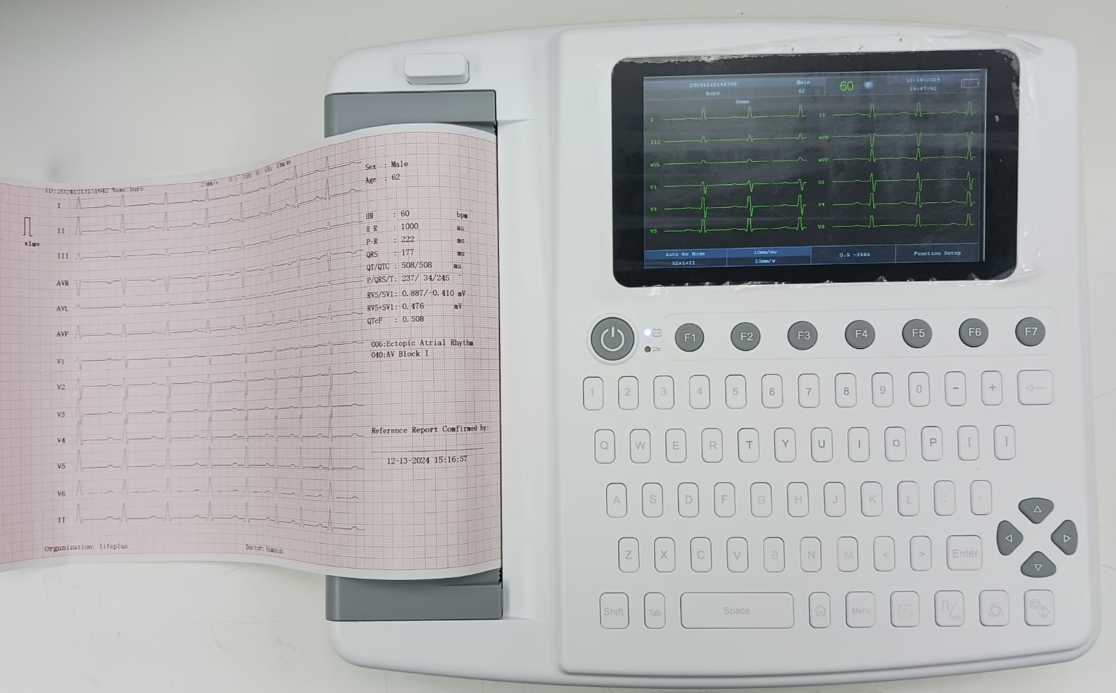 Life Plus 12 Channel ECG Machine - Global Surgicals