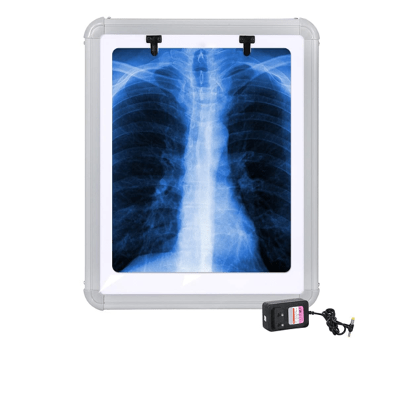 LIFEX LED X Ray View Box - Global Surgicals