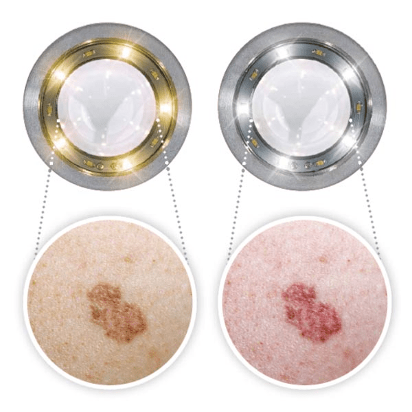 Luxamed LuxaScope Auris CCT LED 2.5V - Global Surgicals