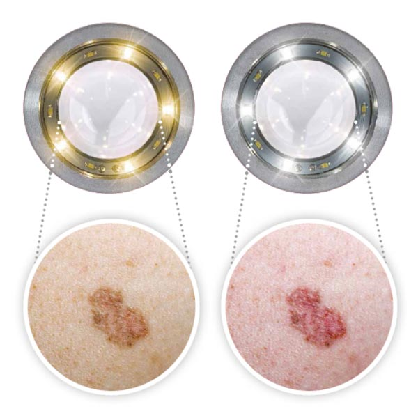 Luxamed LuxaScope Auris LED 2.5V