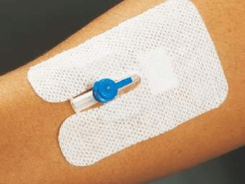 Medigrip IV Cannula Adhesive Bandage - Global Surgicals
