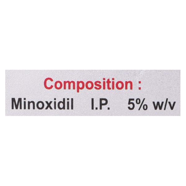 Minscalp 5% Solution 60ml - Global Surgicals