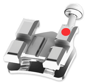 Modern Orthodontics Sapphire True Twin MIM - Global Surgicals
