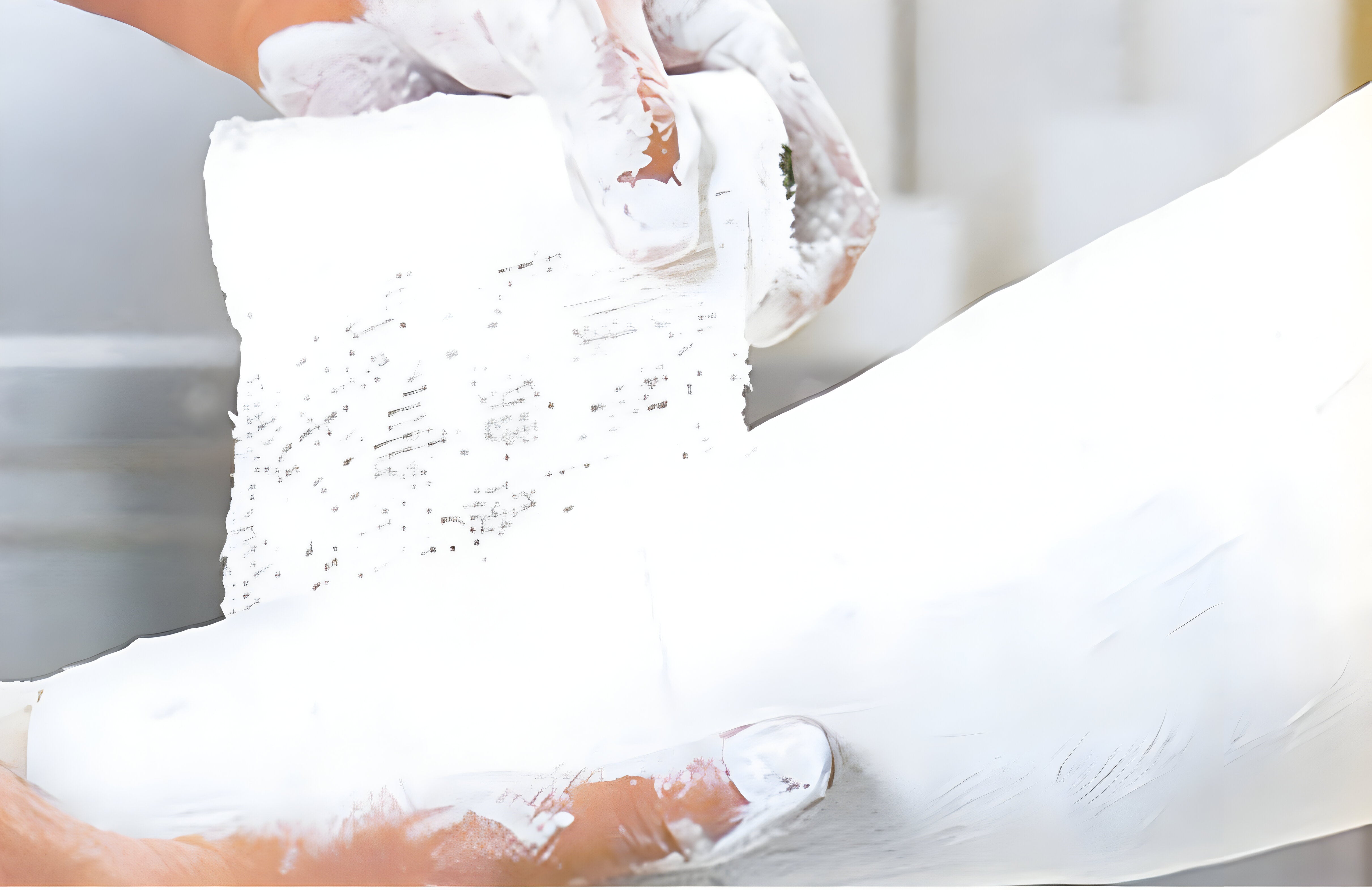 TecHeal Wondercast Gold Plaster of Paris Bandage B.P