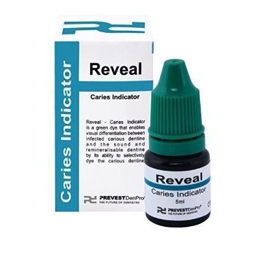 Prevest DenPro Reveal Pit & Fissure Sealant - Global Surgicals