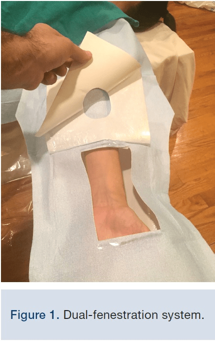 Primewear Economy Cathlab Drape - Global Surgicals
