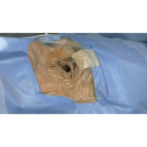 Primewear Eye Drape - Global Surgicals
