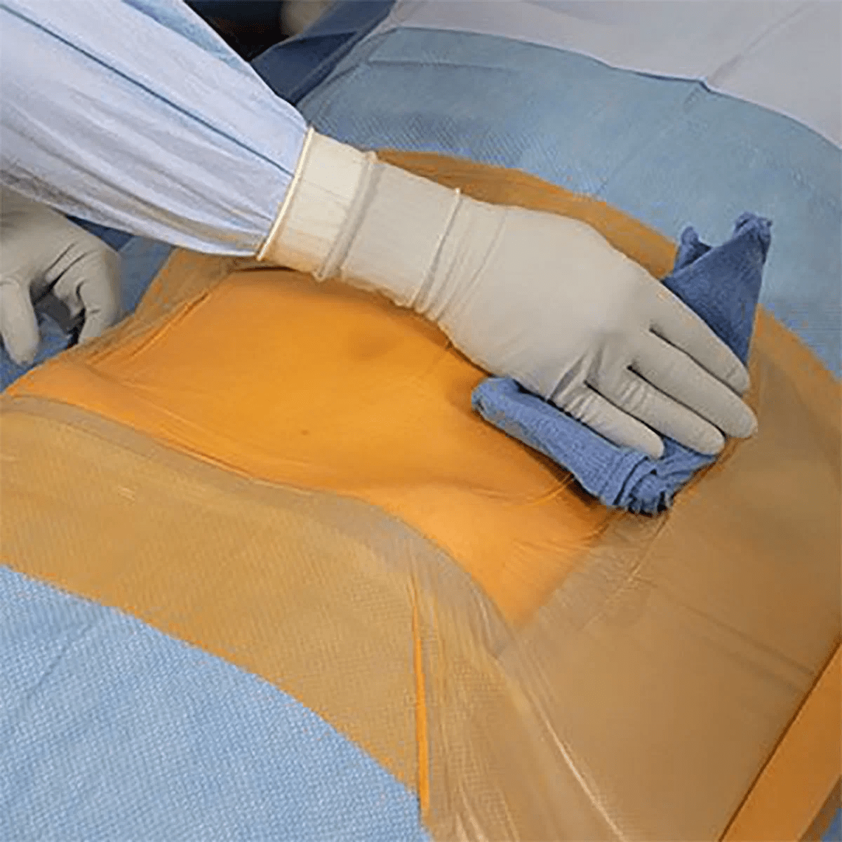 Primewear Iodine Incise Drape - Global Surgicals