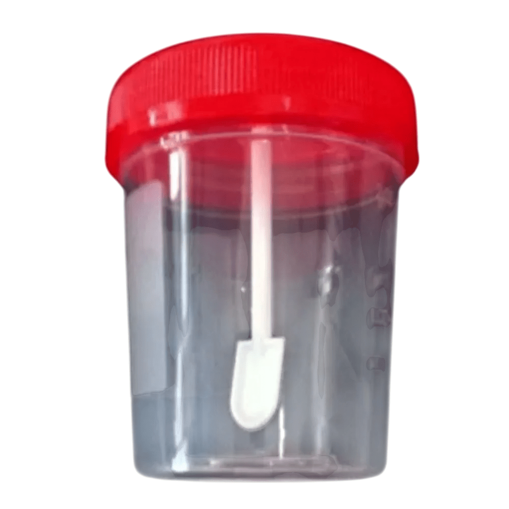 Recombigen Stool Container - Global Surgicals