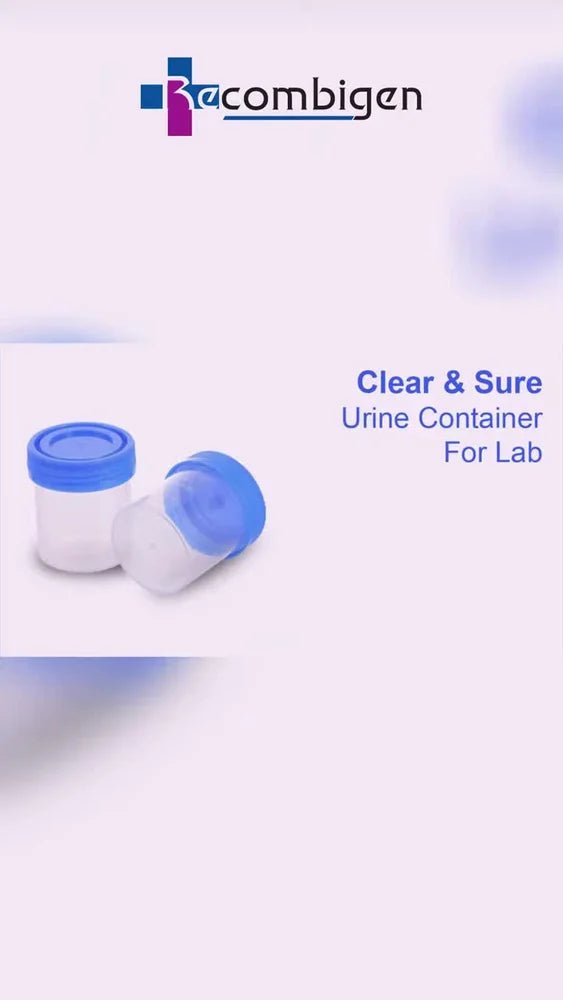 Recombigen Urine Container - Global Surgicals