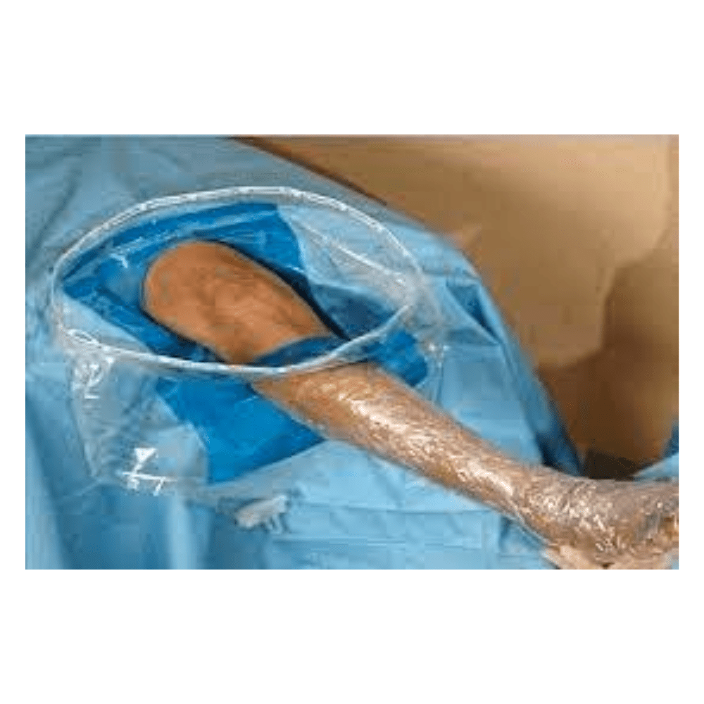 Slaney Arthroscopy Knee Drape - Global Surgicals