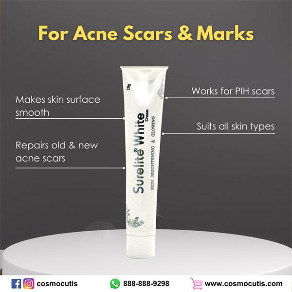 SURELITE WHITE Cream 20gm - Global Surgicals