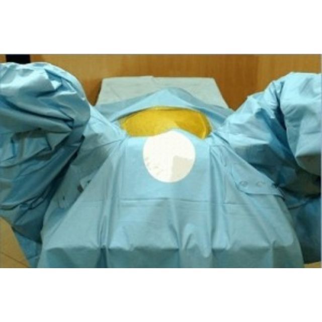 Surgiwear Abdomino - Peritoneal Drape - Global Surgicals
