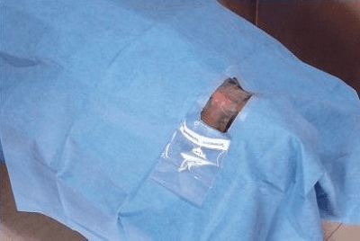 Surgiwear ECO Eye Drape - Global Surgicals