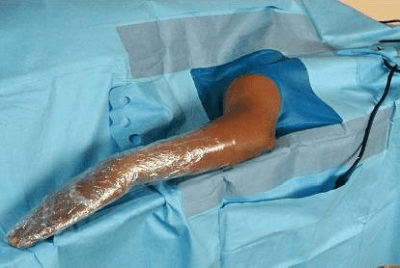 Surgiwear Elbow O Drape - Global Surgicals